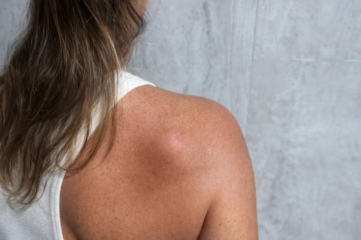 As pequenas cirurgias oferecem solução definitiva com grande foco na qualidade da cicatriz final.